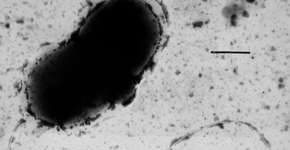 Foto: (reprodução/Wikimedia Commons)