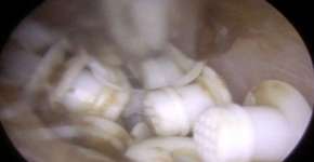 Foto: (reprodução/Youtube)