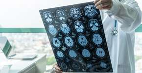 Foto: (iStock/Chinnapong)