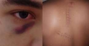 Jovens são torturados em centro para menores infratores no Piauí