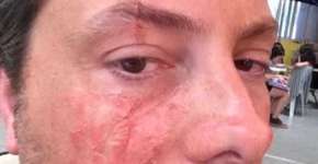 Foto: (Imagem sem texto alternativo disponivel ID [1685156])