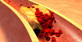 Foto: (Ralwel/istock)