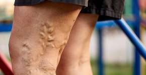 Foto: (troyanphoto/DepositPhotos)