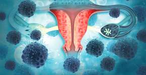 Médico viraliza ao mostrar tumor para incentivar Papanicolau