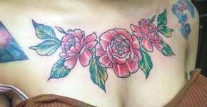 Jovem divulga fotos para alertar perigos da remoção de tatuagem