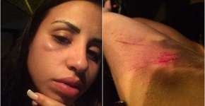 Foto: (Imagem sem texto alternativo disponivel ID [1172569])