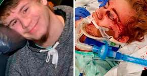 Adolescente de 14 anos aceita desafio compartilhado no Youtube e quase morre