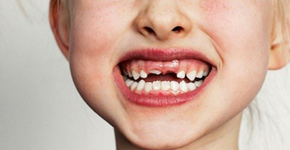 Pode abrir um sorrisão. A Colgate está com vagas em aberto