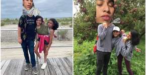 Gêmea siamesa desabafa sobre estragar fotos da irmã e namorado