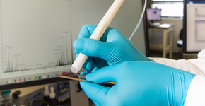 Caneta inovadora que detecta câncer é testada no Brasil e promete diagnóstico em segundos