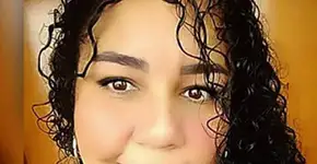 Mulher tem reação alérgica gravíssima depois de pintar o cabelo