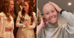 Atriz de “Anne With an E” retira os dois seios devido a câncer