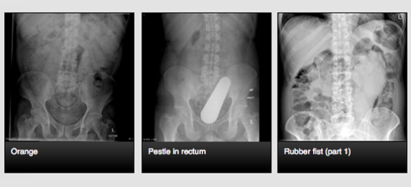 Divulgação: Radiopedia 