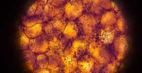 Foto: (jxfzsy/istock)