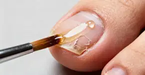 4 passos para usar óleo de melaleuca e curar micose