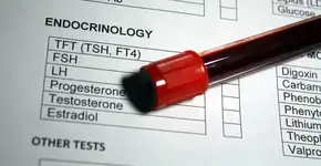 Foto: (Hailshadow/istock)