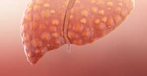 10 alimentos que vão te ajudar a reduzir gordura no fígado