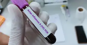 6 pontos cruciais sobre a gripe aviária: principais sintomas, formas de prevenção e mais