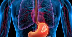 Foto: (peterschreiber.media/istock)