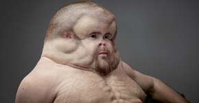 Foto: (Imagem sem texto alternativo disponivel ID [1836594])