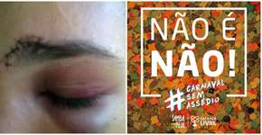 Foto: (Imagem sem texto alternativo disponivel ID [1031048])