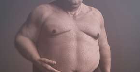 Excesso de peso pode estar ligado a 8 tipos de câncer