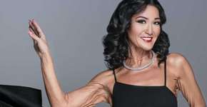 Modelo de 26 anos com rugas prematuras dá show de superação