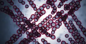 Foto: (BlackJack3D/istock)