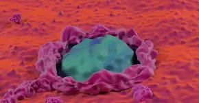 Um copo diário dessa bebida pode reduzir o risco de câncer de intestino em 17%