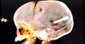 Foto: (Reprodução/TV Globo)