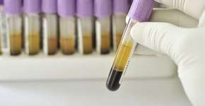 Foto: (Istock/© jarun011)