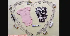 Mulher mostra fotos emocionantes de processo de fertilização