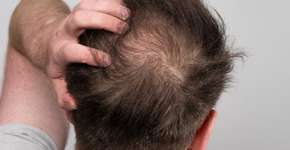 Esta bebida causa a queda de cabelo