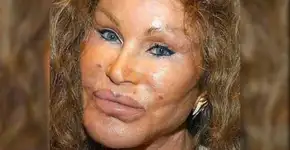 Conhecida por plásticas, socialite volta aos jornais por polêmica