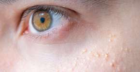 Foto: (Getty Images/iStockphoto)