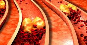 Foto: (iStock/Ralwel)