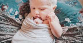 Mãe descobre que a filha é albina e faz depoimento emocionante