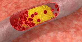 Foto: (Imagem sem texto alternativo disponivel ID [1833911])