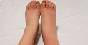 Foto: (Tamiko Ihori/istock)