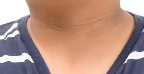 Foto: (iStock/kwanchaichaiudom)