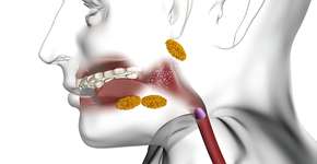 Foto: (Ozgu Arslan/istock)