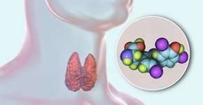 Foto: (katerynakon/Deposit Photos)