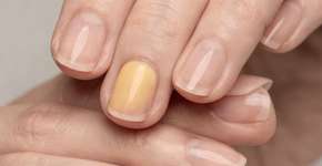 Foto: (Imagem sem texto alternativo disponivel ID [2686972])