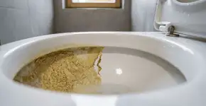 Foto: (Imagem sem texto alternativo disponivel ID [2760475])