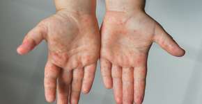 Foto: (kipgodi/istock)