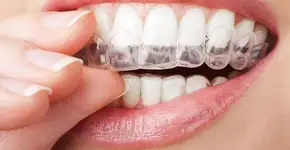 Uerj seleciona voluntárias para pesquisa sobre bruxismo