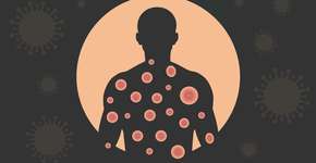 Foto: (buraktumler/istcok)