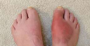 Foto: (iStock/Robert Kirk)