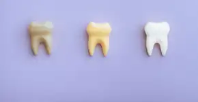 5 mitos e verdades sobre manchas nos dentes