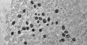 OMS convoca reunião de emergência para tratar de epidemia